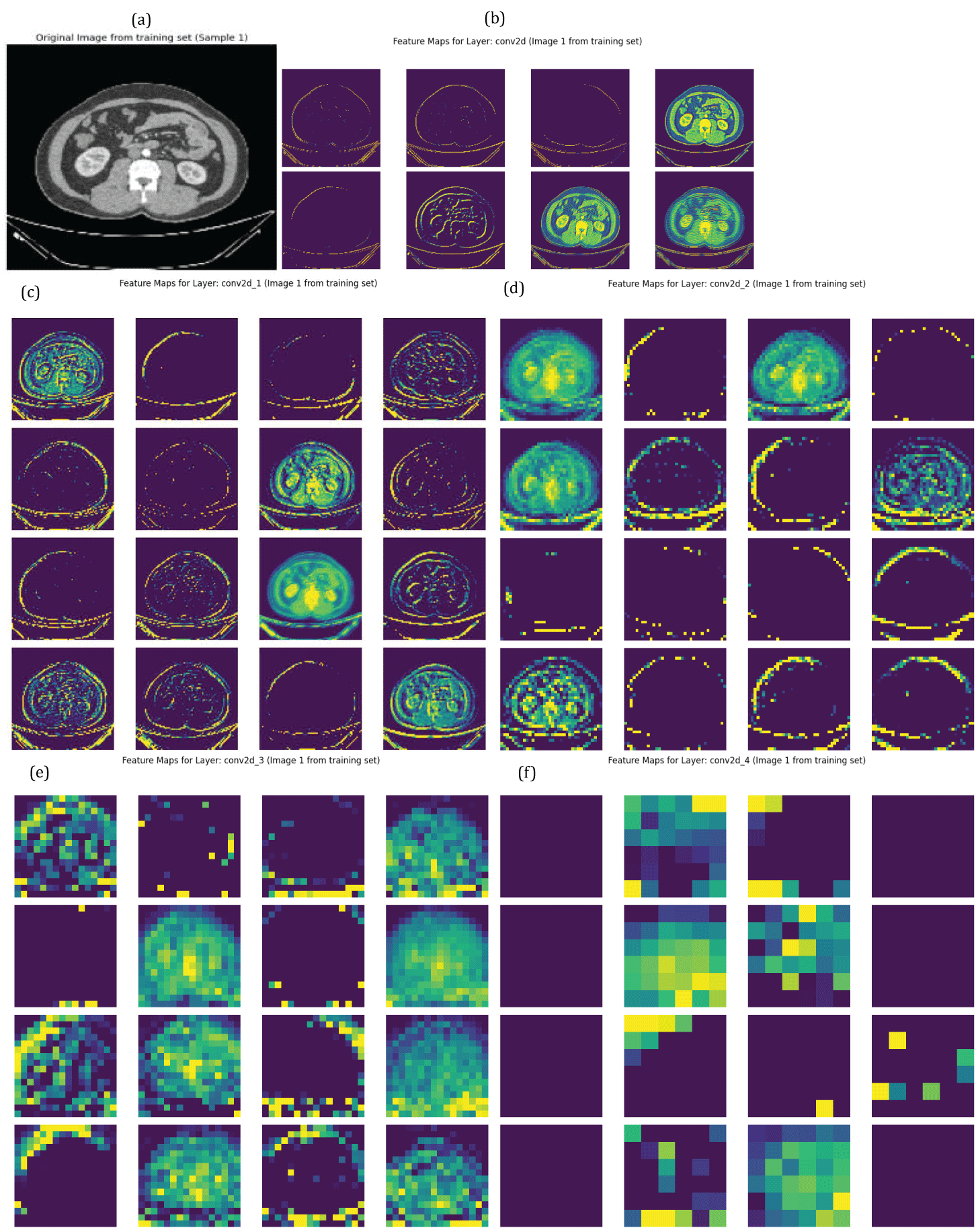 Feature Maps of Five Convolutional Layers obtained from deep CNN model (a) original image (b) convolutional layer1 output (c) convolutional layer2 output (d) convolutional layer3 output (e) convolutional layer4 output (f) convolutional layer5 output..