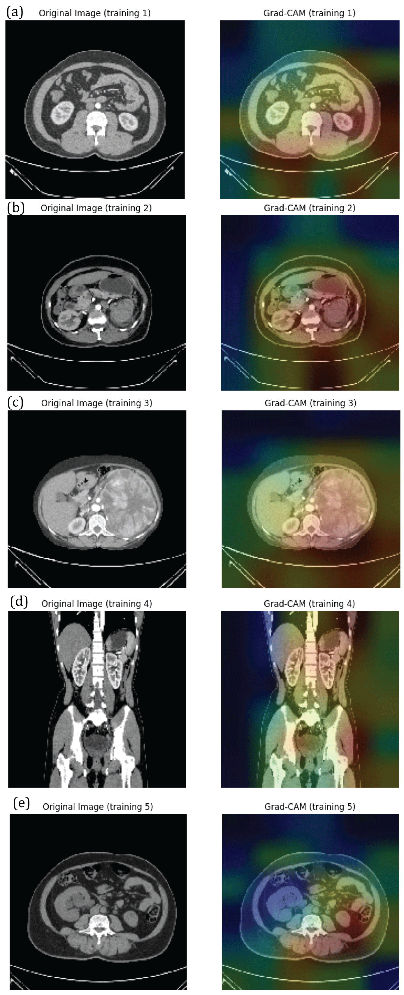 Grad-Cam Visualizations obtained from deep CNN model (a) Training image1 (b) Training image2  (c) Training image3 (d) Training image4 (e) Training image5.