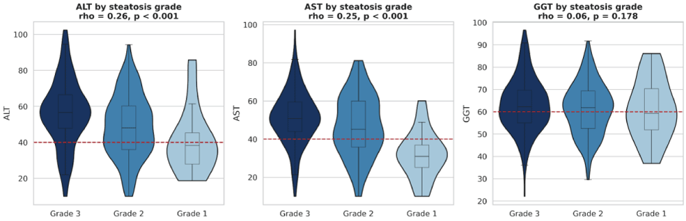 Distribution of liver biochemical markers across imaging-defined steatosis grades. Violin plots with overlaid box plots compare alanine aminotransferase, aspartate aminotransferase, and gamma-glutamyl transferase across Grades 1–3. Horizontal reference lines indicate approximate upper limits of normal. Alanine and aspartate aminotransferase show ordered upward shifts, whereas gamma-glutamyl transferase does not show a statistically significant linear trend (p = 0.134).